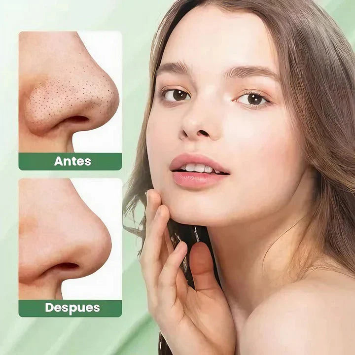 MASCARILLA FACIAL DE BARRO TE VERDE® - LIMPIEZA PROFUNDA